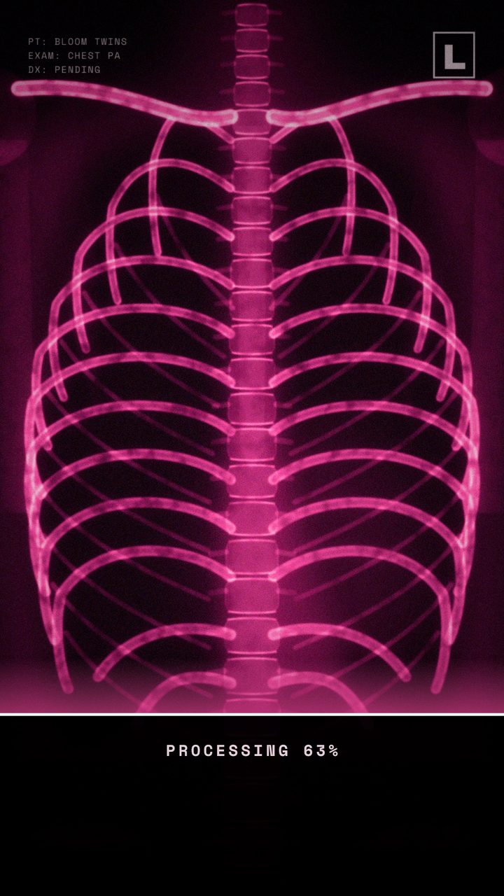 An X-ray scan developing, processing 63 percent