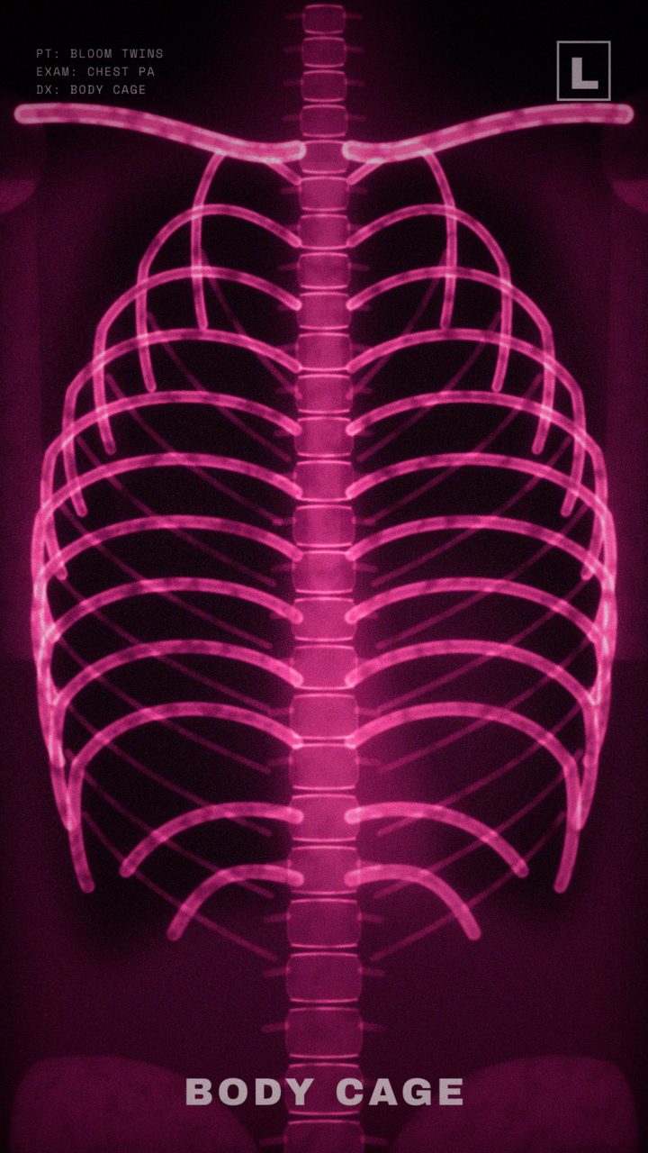 A pink chest X-ray of a ribcage